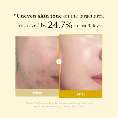 Kojic Acid Turmeric Overnight Face Mask for Glowing Skin