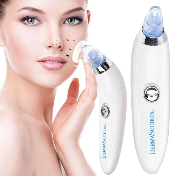 🔥 Pore Cleaning Device – Electric Blackhead Remover & Facial Cleanser